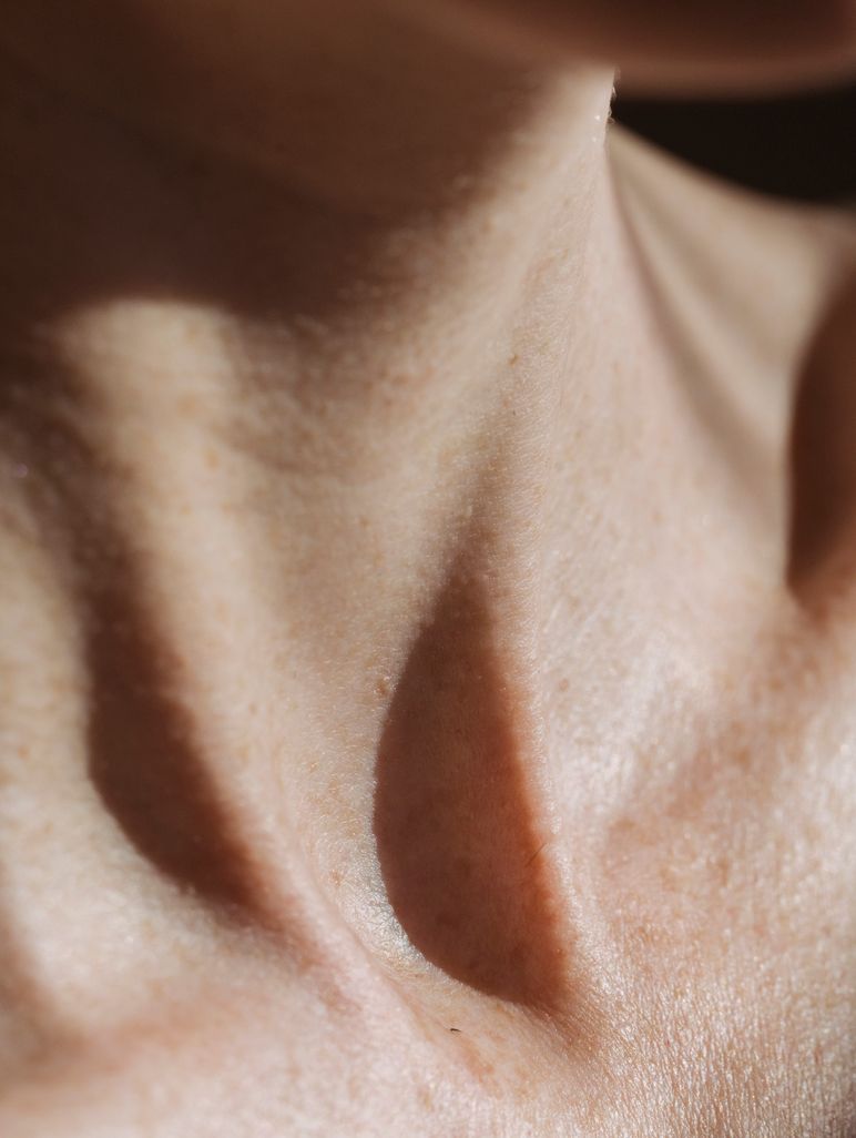 Neck (Front or Back) laser hair removal treatment