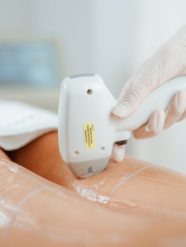 1/4 Arms laser hair removal treatment